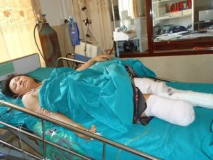 UXO survivor Ms. Bouakham laying in hospital bed