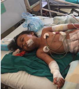 young girl injured by uco accident in hospital bed