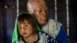 UXO survivor Yeyang and his daughter, photographed for the Irish Times